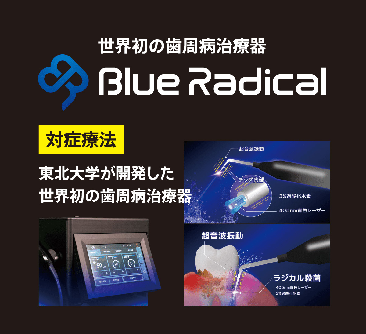 ホワイトニングの症例
